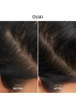 Anti-Dandruff Shampoo