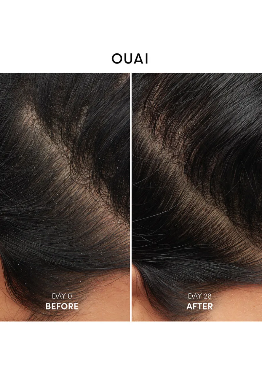 Anti-Dandruff Shampoo