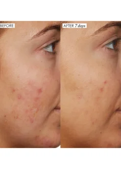 B3 Nice 10% Niacinamide Serum 30ml