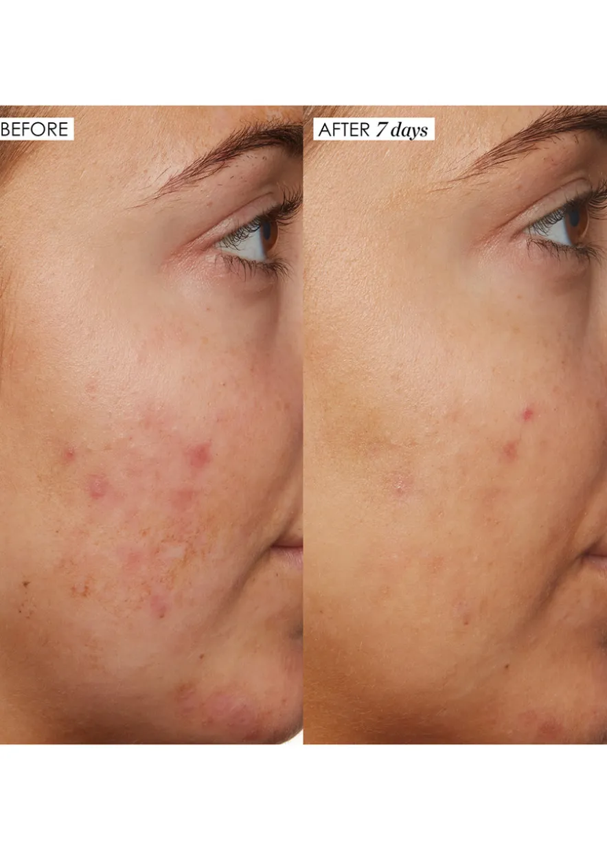 B3 Nice 10% Niacinamide Serum 30ml