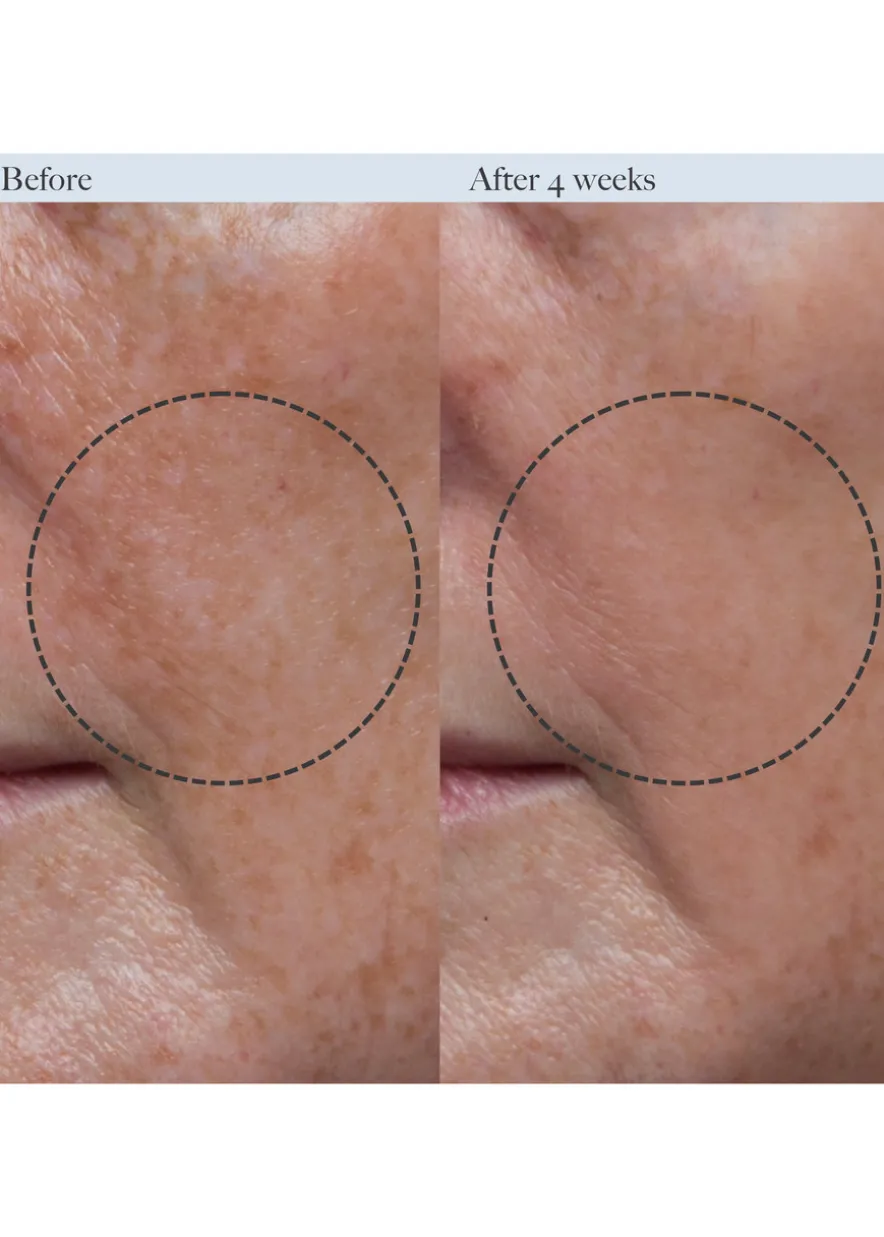 Concentrated Firming Serum