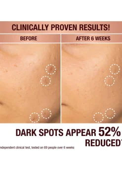 Dark Spot Correcting Radiance Recovery Serum 30ml