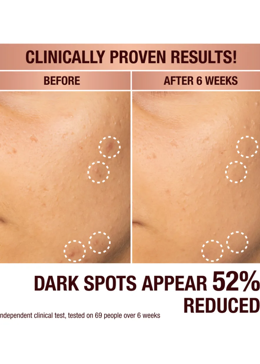 Dark Spot Correcting Radiance Recovery Serum 10ml