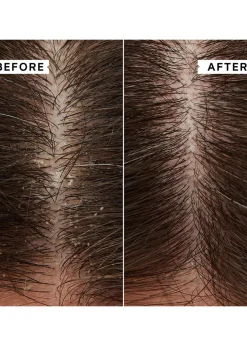 Flaky/Itchy Scalp Mask 20ml X 2