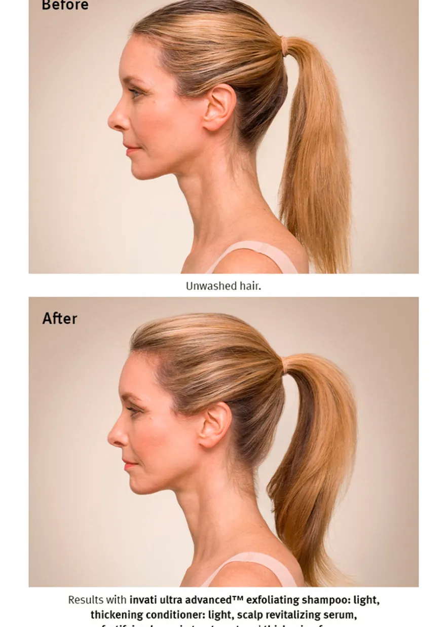 Invati Ultra Advanced™ System: Light