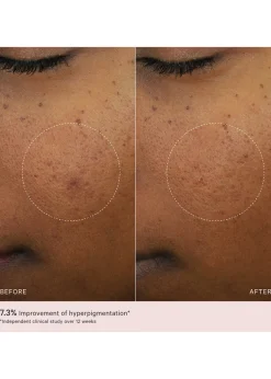Micro Peeling Glow Essence