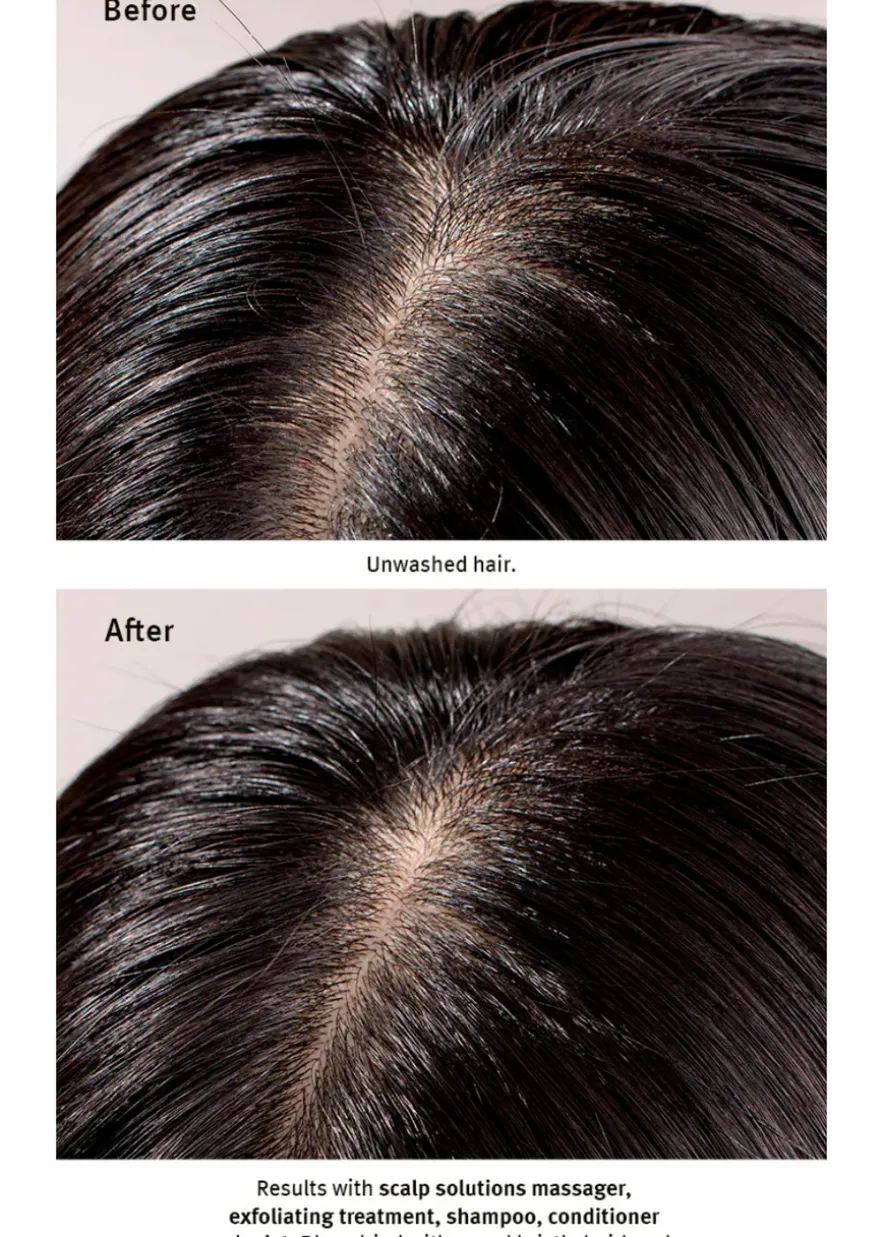 Scalp Solutions Exfoliating Scalp Treatment (Infused with Salicylic Acid) 150ml