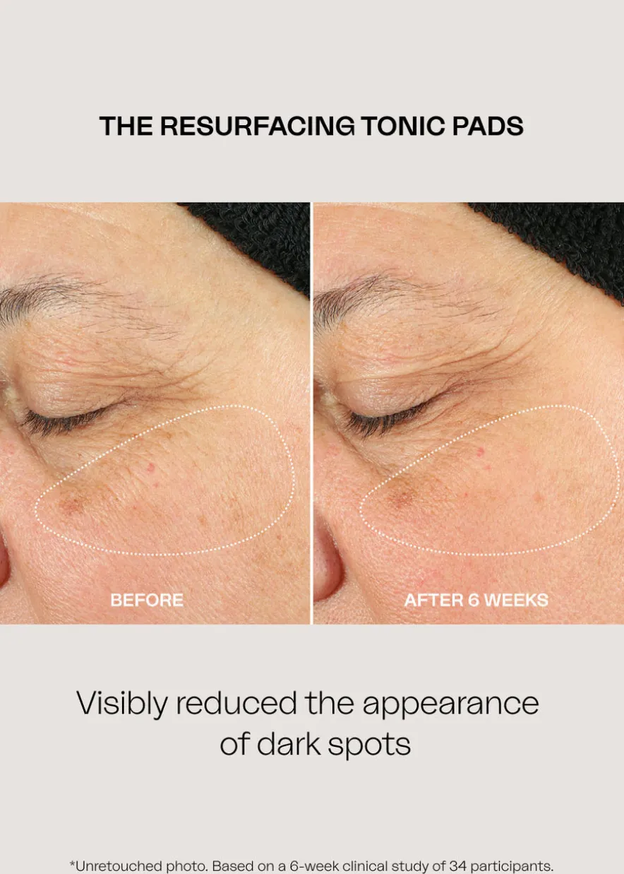 The Resurfacing Tonic Pads