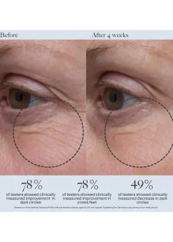 Tightening Eye Gel