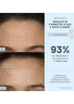 TRINITY+® Wrinkle Reducer Attachment
