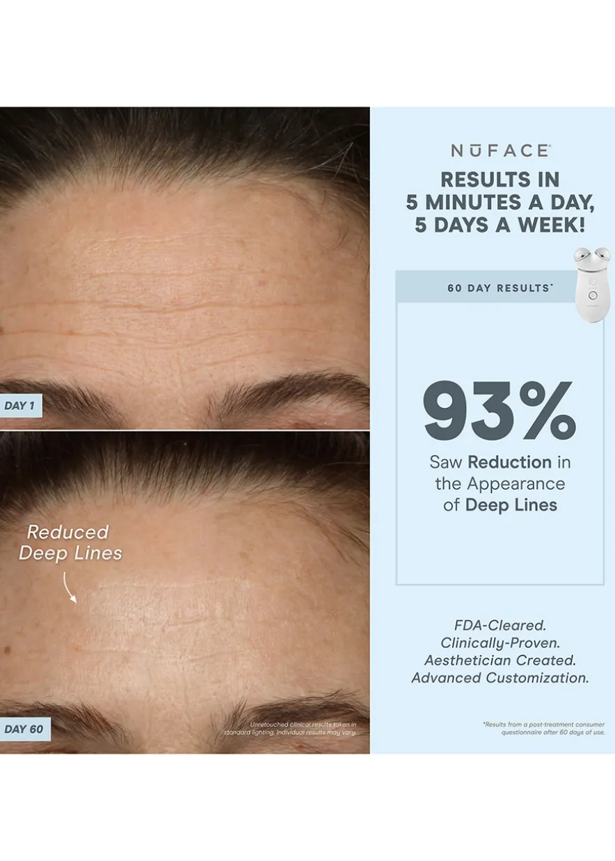 TRINITY+® Wrinkle Reducer Attachment